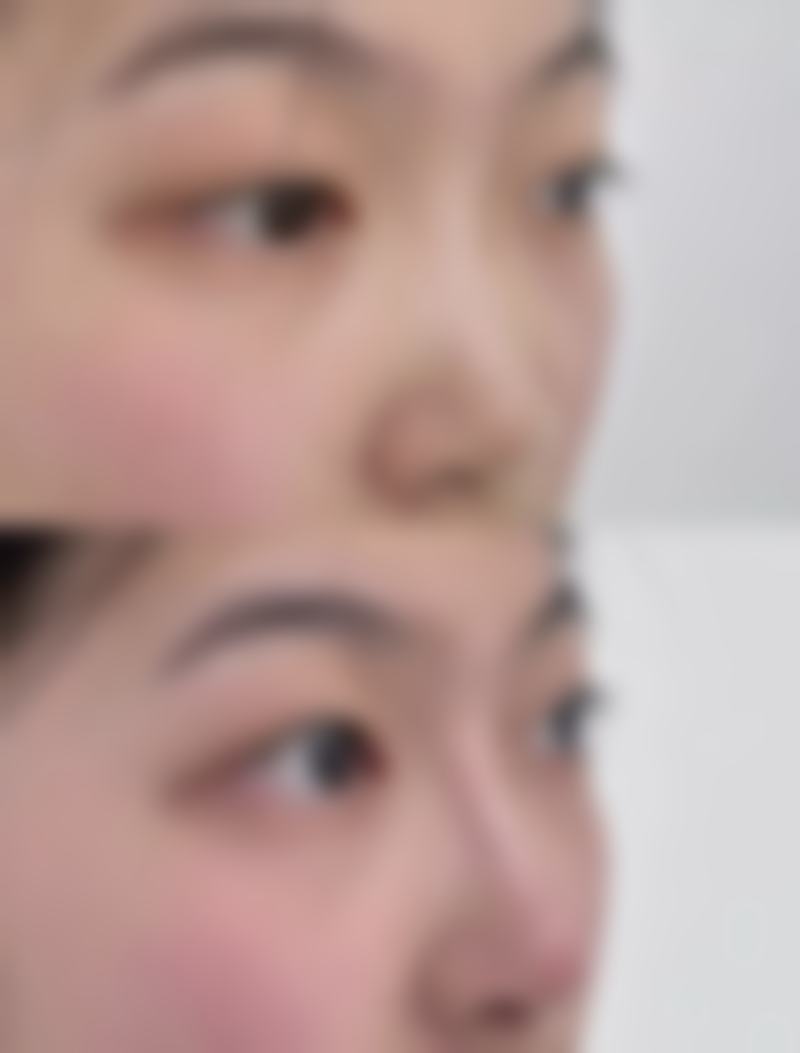 百色贞韩医疗美容诊所(贞韩植发医院)口碑怎么样