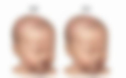 硅胶隆鼻哪个比较好？3大热门硅胶材料深度剖析，解答你的隆鼻疑惑，让你轻松选对！ 