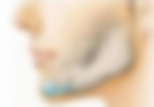 呼和浩特京美医疗美容医院双眼皮手术缝针情况怎么样