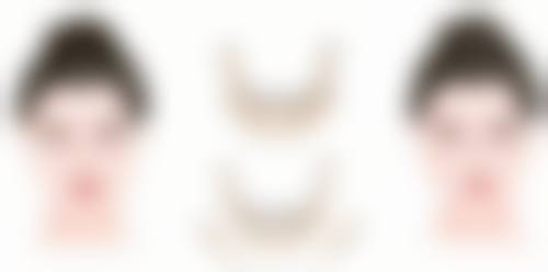 疤痕修复期是多久？了解3大关键因素，掌握2种加速修复方法，让你的疤痕修复不再漫长！ 