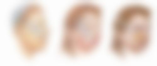 北京嘉禾医疗美容去眼袋适合我吗?