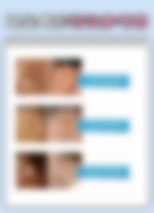 河南商丘冰之薇医疗美容医院真实实例