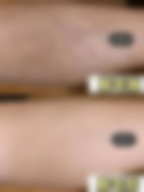 河南商丘冰之薇医疗美容医院价格表