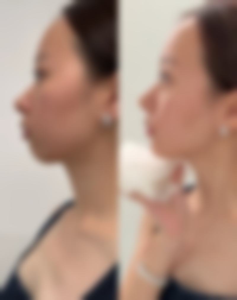 马雪鸣医生看诊优势