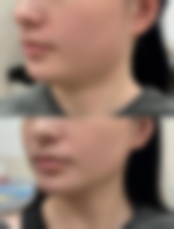 沈阳中韩碧航长青医学整形医院口碑怎么样