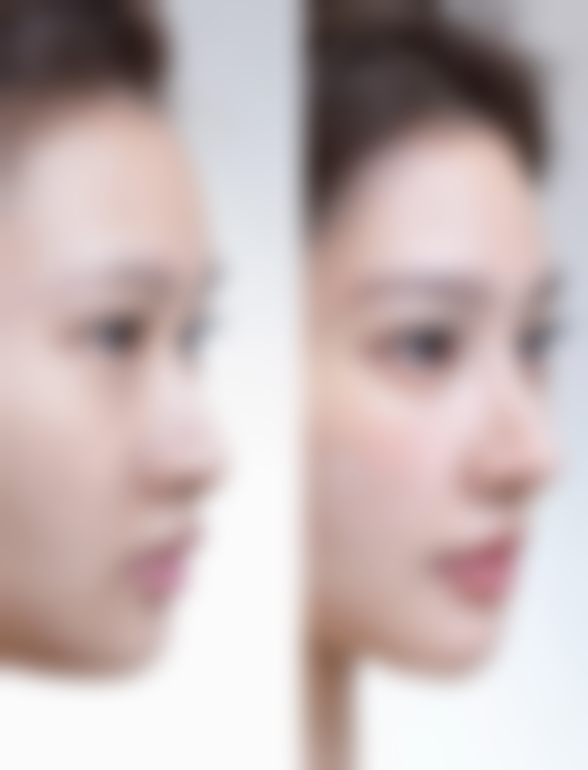 ve能去除眼袋吗怎么用？揭秘ve去眼袋的科学真相，3种实用用法让你告别熊猫眼，试试吧！ 