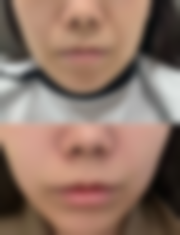 东莞和美人整形医院医生名单：专精团队为美护航