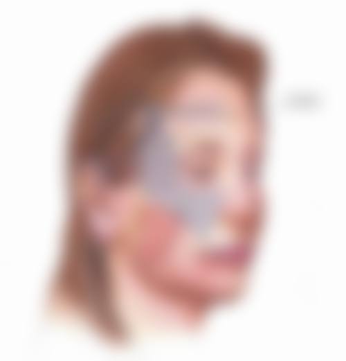 杨娜医生之医美真实实例大分享