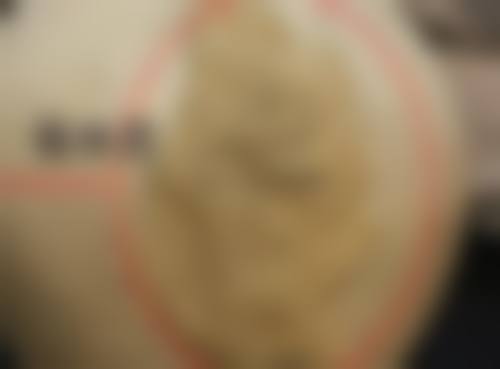 疤痕增生变软是好的征兆吗？深度解析3大原因告诉你这或是康复信号，助你告别疤痕困扰！ 