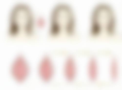 杨娜医生之医美技术特点超独特