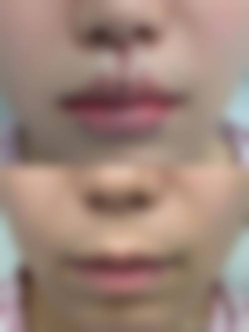 乌兰浩特市人民医院整形美容科仪器设备：精良科技助力美丽升级