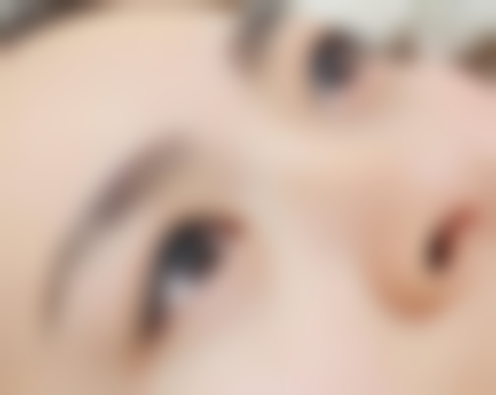 沈阳杏林整形对疤痕增生变软后续处理怎么样？