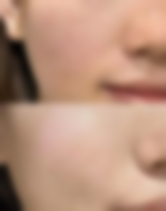 韩国Reborn整形外科真实实例