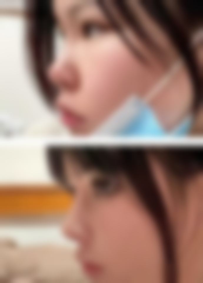 韩国Reborn整形外科仪器设备