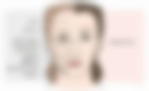 北京画美医疗美容割双眼皮后经常玩手机会导致眼部留疤吗？