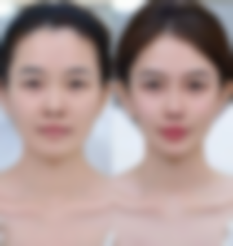 疤痕修复凝胶涂6个月值不值？