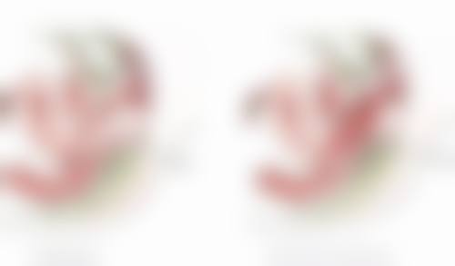 沈阳杏林整形改善眼袋值不值？