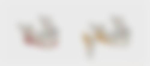 北京圣嘉新医疗美容医院双眼皮手术过程时间适合吗？