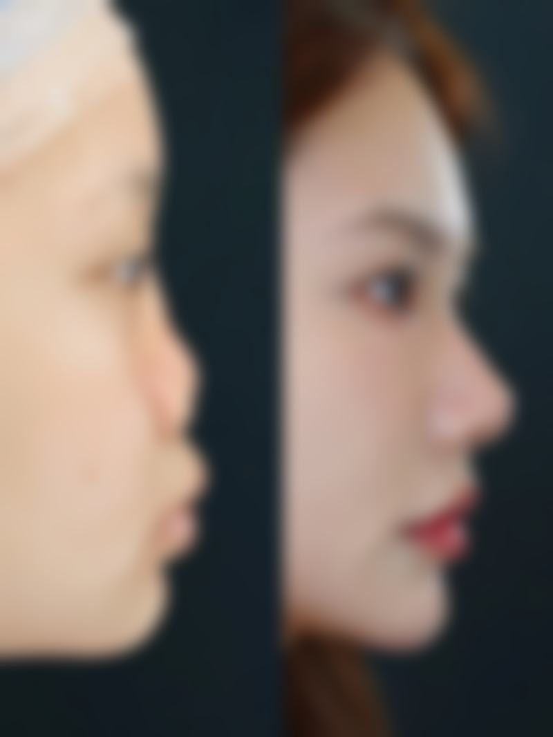 长沙悦辰医疗美容门诊部擅长项目：多样选择满足你