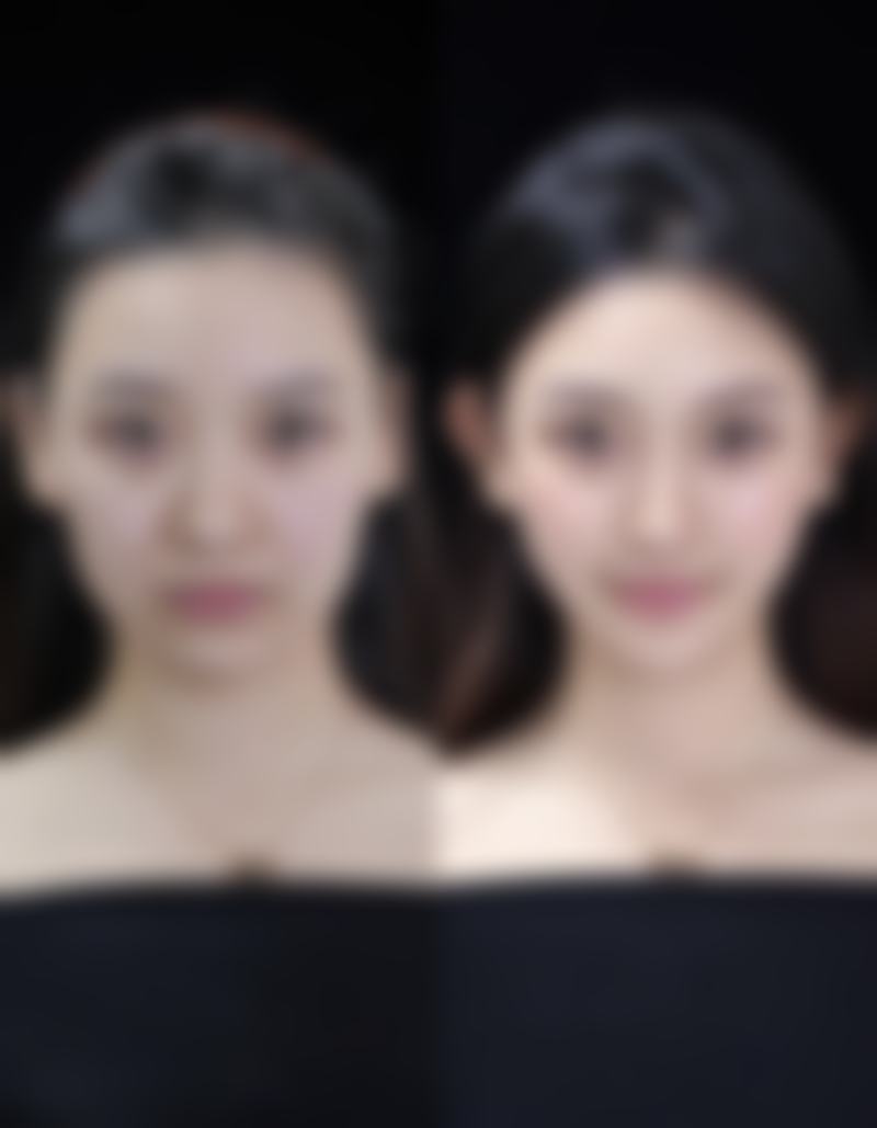 廖培姣医生技术特点