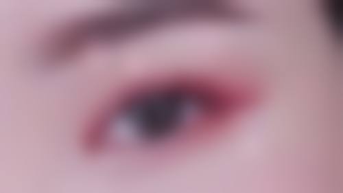 北京嘉禾医疗美容做去眼袋手术术后修复黄金7天怎么护理？