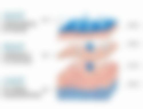 做去眼袋手术注意什么？术后恢复黄金7天怎么护理、哪些食物助恢复、如何避免留疤，一次性全揭秘！ 