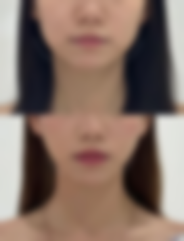 八王子Skin Care仪器设备