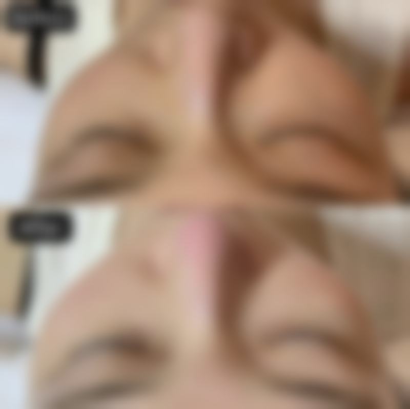 安徽维纳斯综合医院价格表