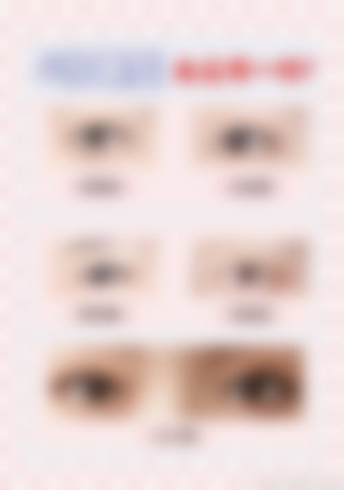 上海坤雅虹美医疗美容门诊部擅长项目