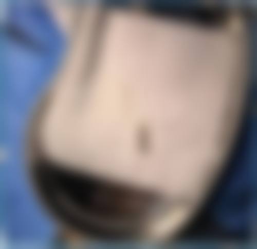 长诺美医疗美容医院擅长项目