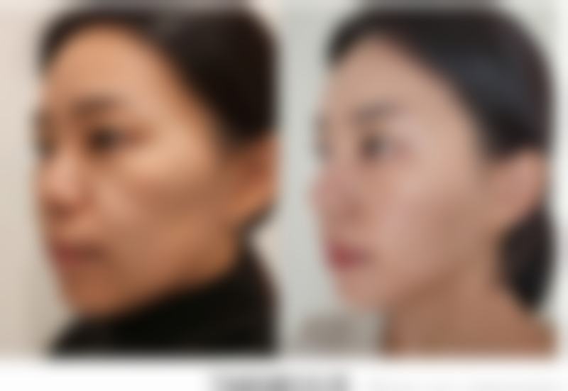 上海坤雅虹美医疗美容门诊部口碑怎么样