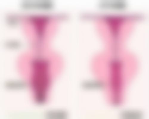 北京禾美嘉医疗美容打完除皱针皮肤特别紧绷怎么缓解？