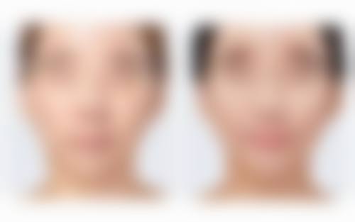 朴在贤医生真实实例