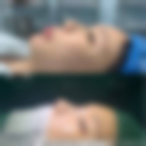 合肥崔劲松医疗美容诊所口碑怎么样