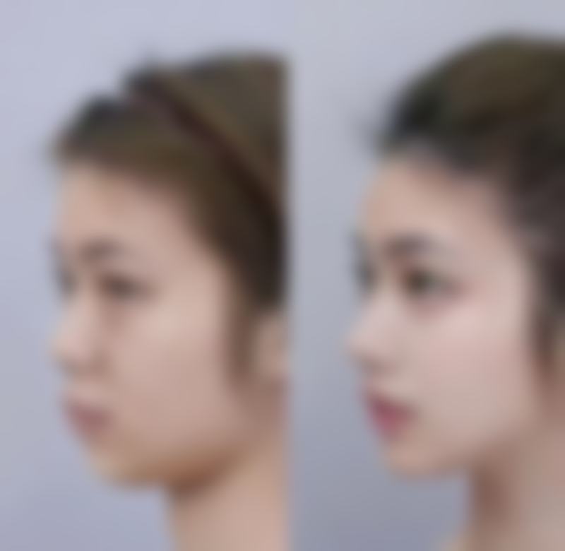 柳松青医生怎么预约挂号