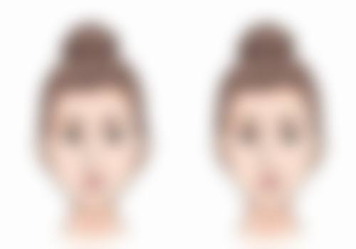 呼和浩特京美医疗美容做眼袋手术修复值不值？