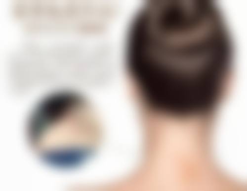 北京圣嘉新医疗美容医院做韩式无痕双眼皮和埋线双眼皮哪个更适合？