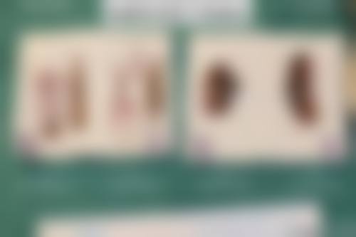 昆明梦想医疗美容医院口碑怎么样：真实评价见分晓