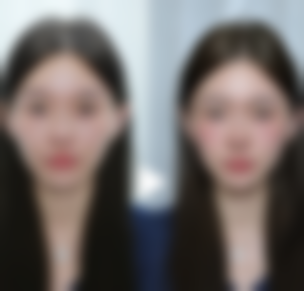 沈阳杏林整形修复坑疤痕适合吗？