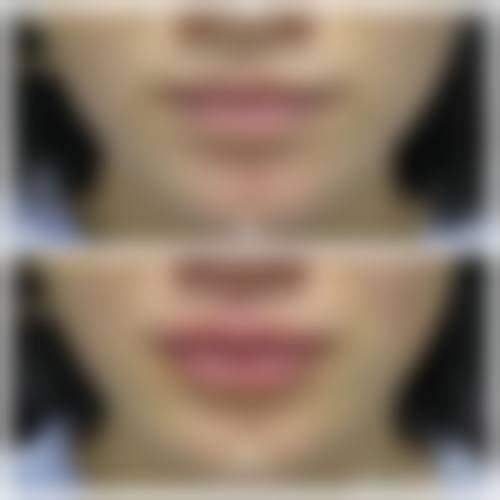 东莞凤岗天天美整形医院营业时间