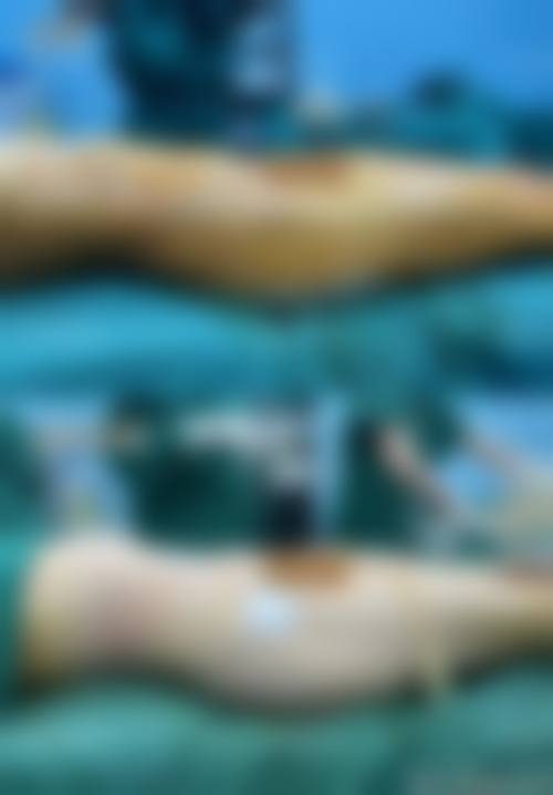 义乌柠栎医疗美容门诊真实实例