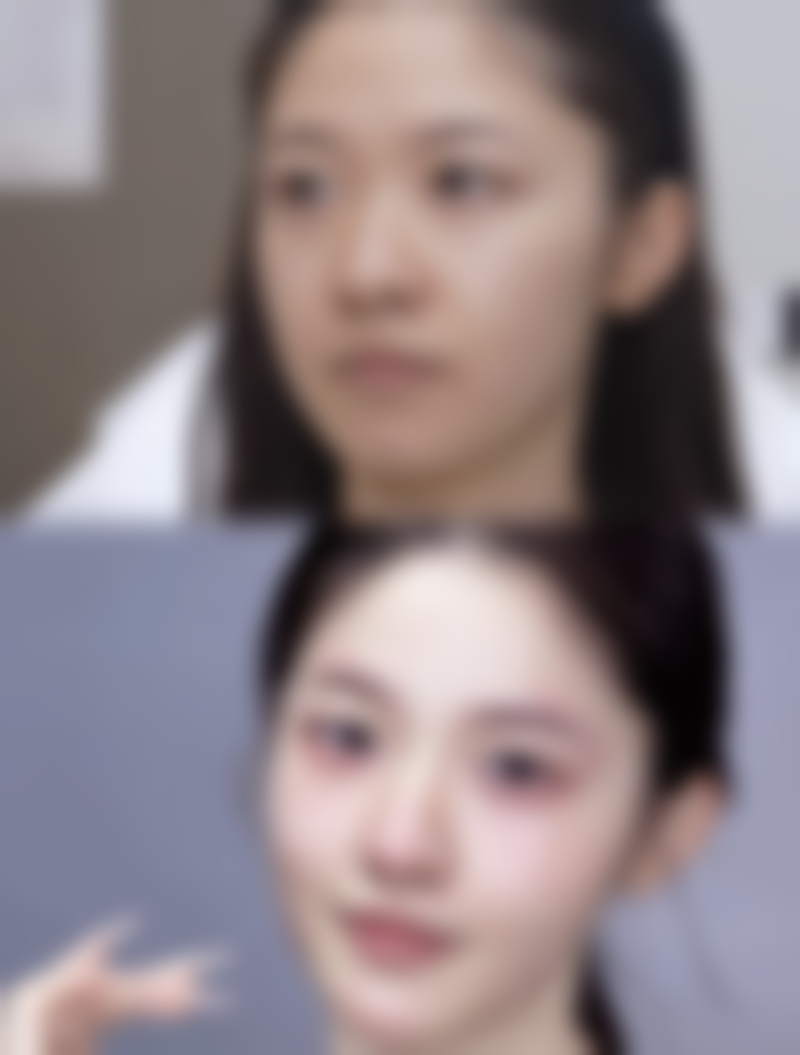 张诚洙医生看诊优势