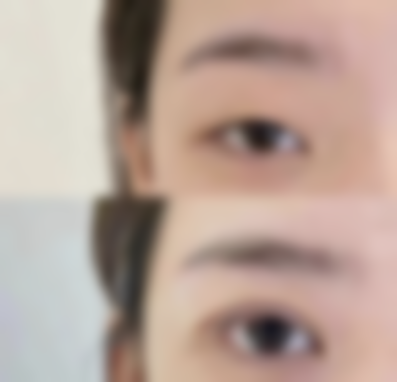 张诚洙医生擅长项目