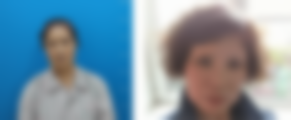 沈阳元辰医疗美容整形医院真实实例