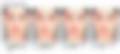 韩国MULY整形外科修复双眼皮没割好怎么样？