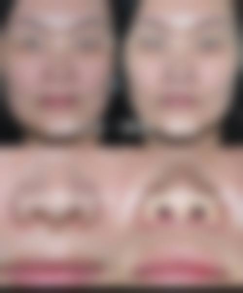 合肥瑞亚整形医院价格表