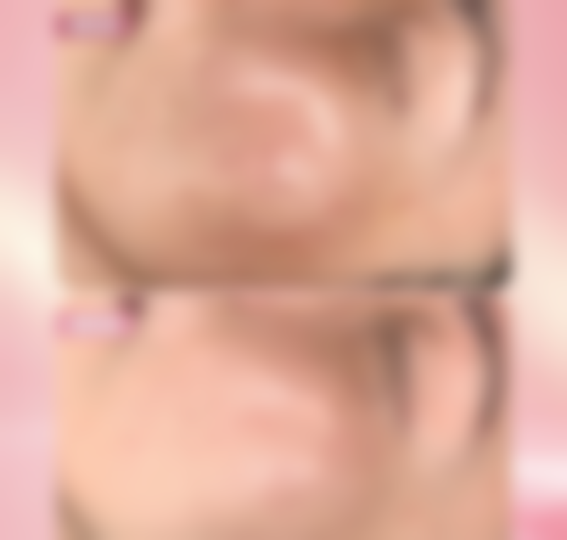 柳松青医生怎么预约挂号