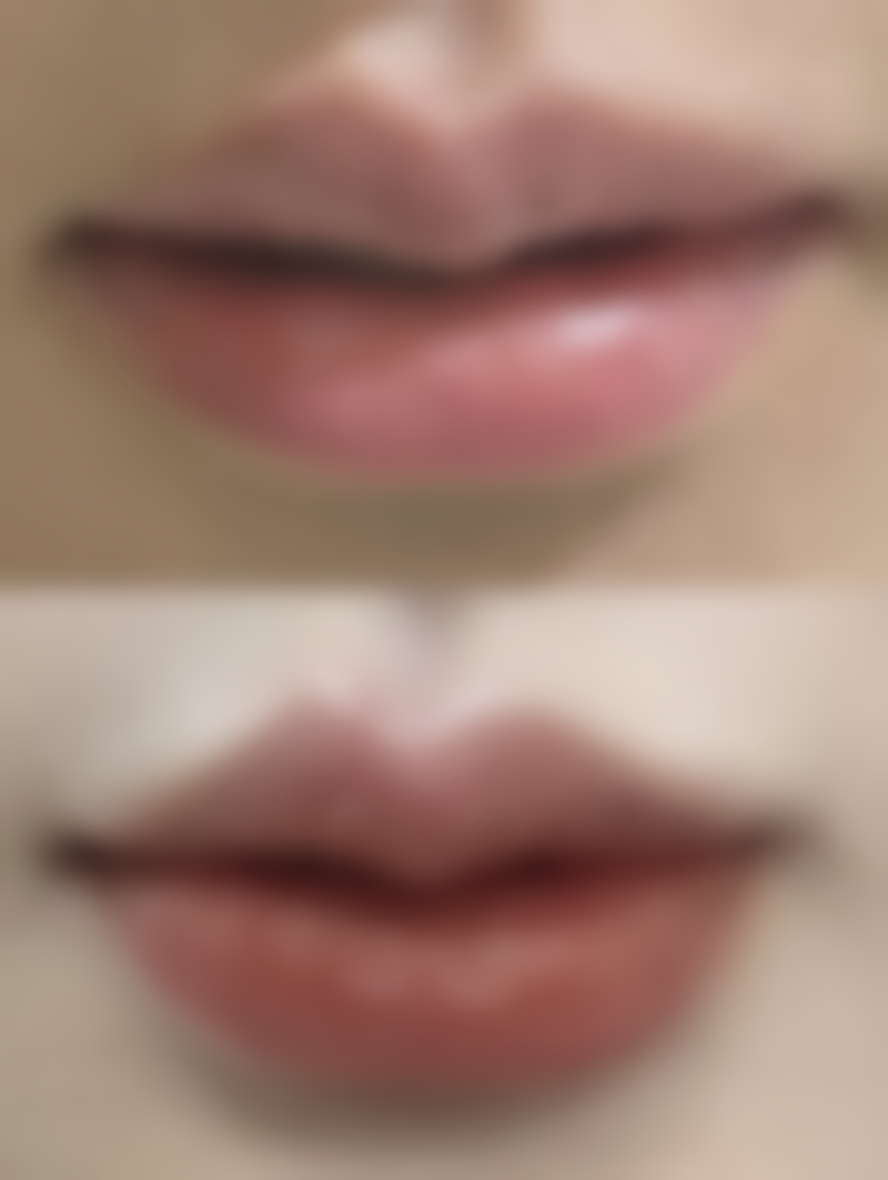 深圳凤贤妇科医院整形科营业时间