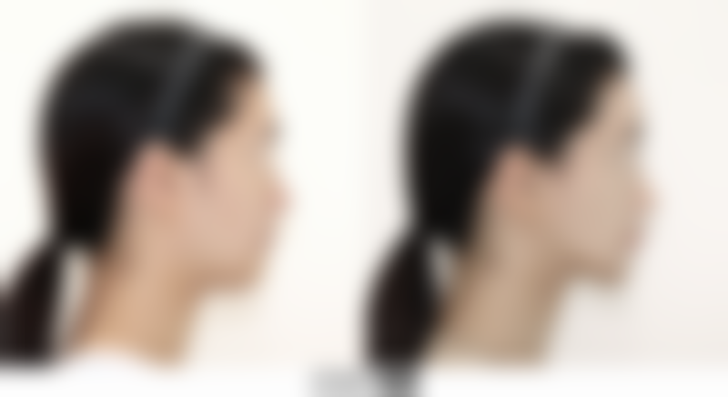 沈阳杏林整形外科医院修复双眼皮没割好靠谱吗？