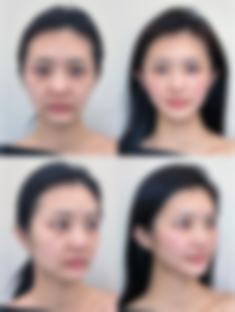 北京瑞泰通潞口腔医院能去掉疤痕红印吗？